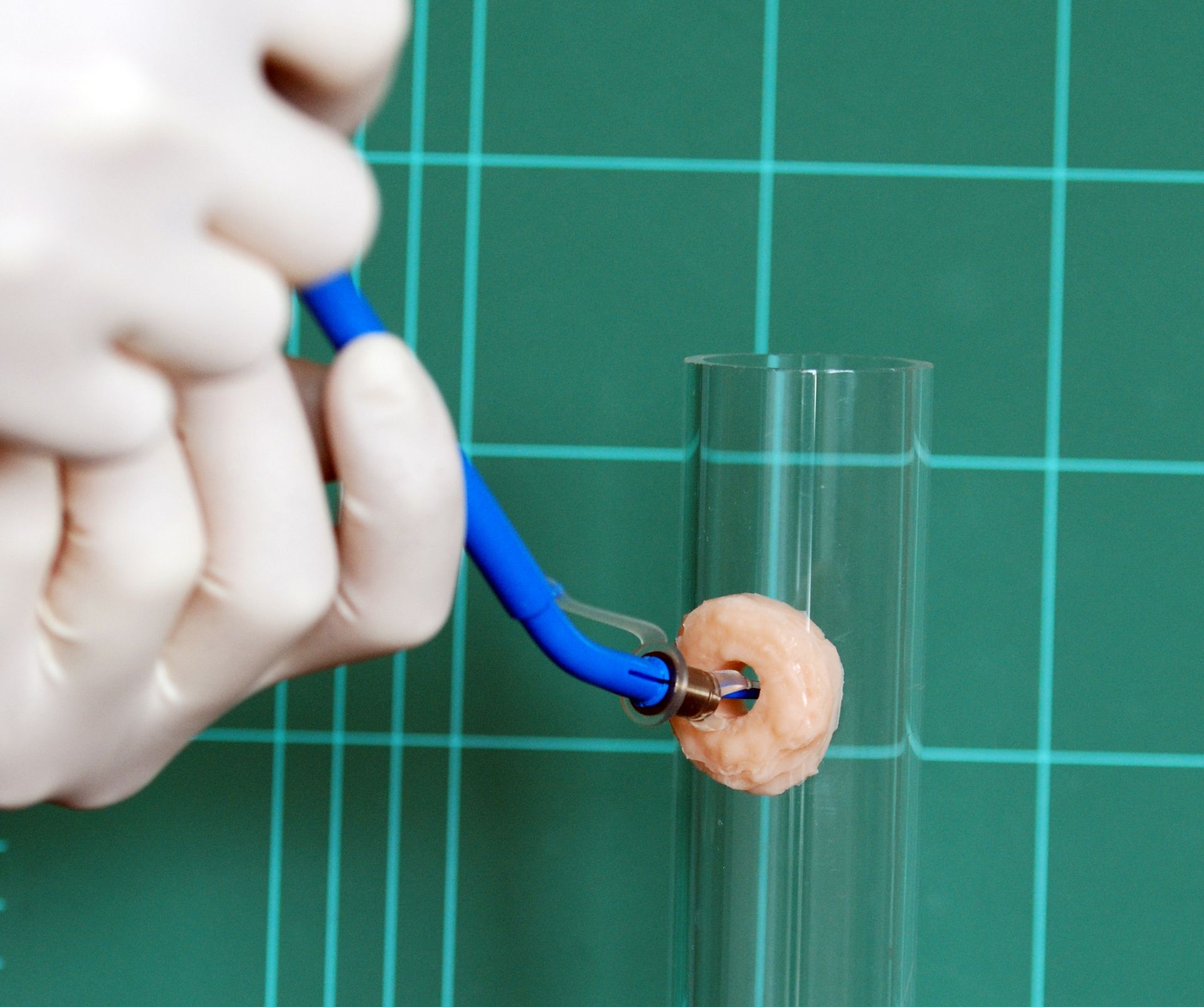 Nun wird die Prothese anterograd in den Shunt eingeführt bis nur noch der tracheale Flansch sichtbar ist.